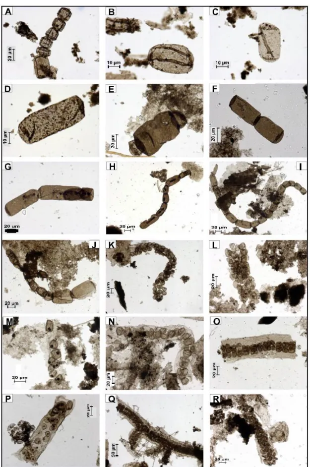 Fig.  9. (A–J) Arctacellularia  tetragonala,  (A)  specimen  65091/X-58-4  with  barrel-shaped  cell  in  one  of  ends;  (B–D)  single  vesicle,  previously  regarded  as A