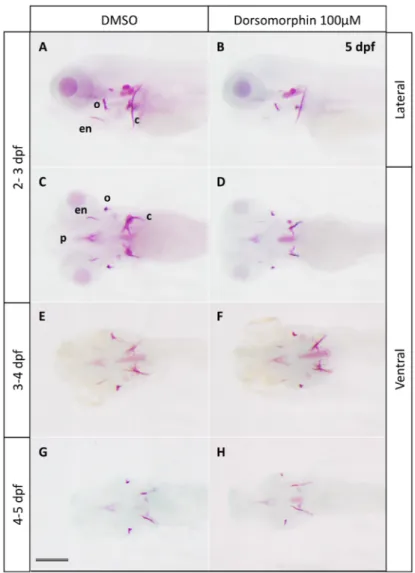 Figure 1. Effects of the BMP inhibitor dorsomorphin on bone mineralization. Alizarin red  staining of 5 dpf larvae treated at 2, 3 or 4 dpf during 24 h with 100 µM dorsomorphin