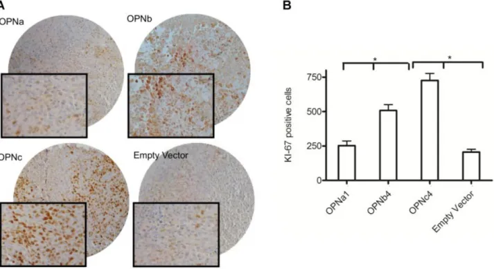 Fig. 2. OPNc and OPNb activate tumor formation by inducing proliferation. Tumors formed by each OPN-SI PC-3 overexpressing cells, as well as empty vector were analyzed for Ki-67 positive staining