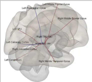 FIGURE 4 | Episodic Migraine Patients’ resting-state fMRI connectome seeded in the right temporo-parietal junction (infero-medial)