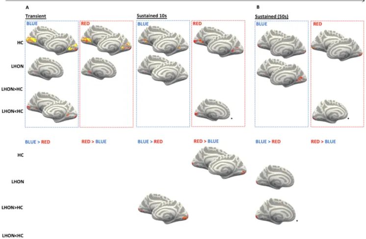 Fig. 2. Brain responses to light stimulations. Significant (TFCE-corrected p  &lt; 0.05) results for LHON and HC brain response to transient effects at light onset (A, left),  10 s sustained effects (A right) and 50 s sustained effects (B) (upper panel) an