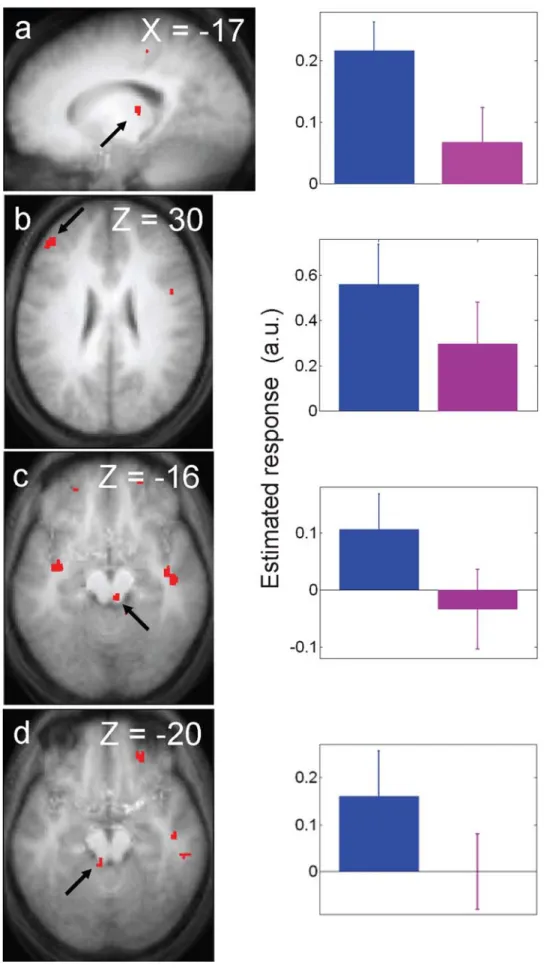 Figure 2. Significant differences between the blue and violet light conditions during the performance of the 2-back task