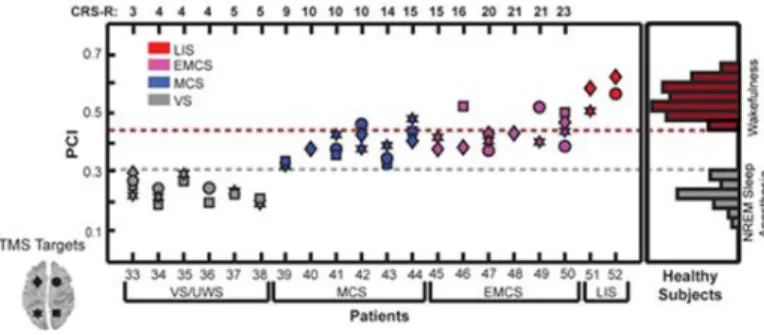 Figure  1:  The  Perturbational  Complexity  Index  (PCI).  PCI  measured  during  consciousness  ranged  between  0.44  and  0.67,  whereas  the  PCI  measured  during  unconsciousness  ranged  between  0.12  and  0.31