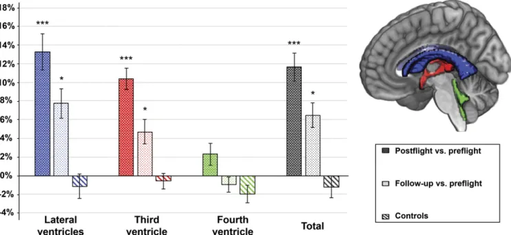 Fig. 1. Percentage volume change for each ventricular CSF compartment, as well as total ventricular volume change given for comparisons postflight vs.