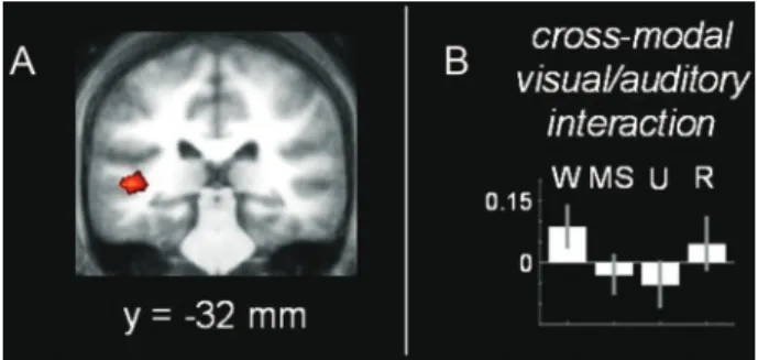 Fig. 5. Cross-modal interactions between visual and auditory networks correlate with the level of consciousness during propofol sedation