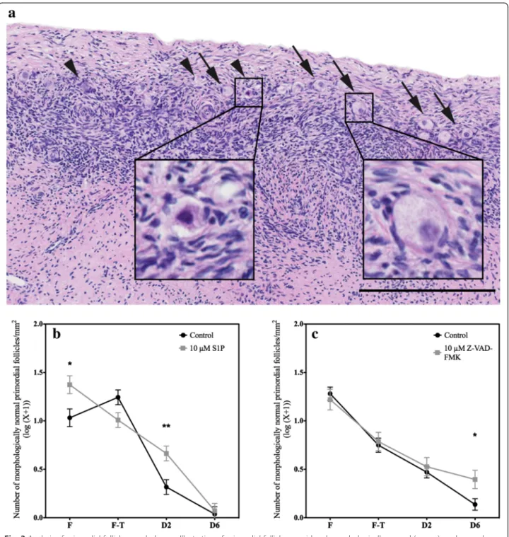 Fig. 3 Analysis of primordial follicle morphology. a Illustration of primordial follicles considered morphologically normal ( arrows ) or abnormal ( arrowheads )