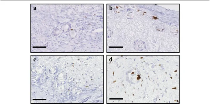 Fig. 5 Illustration of proliferative cells when treated with Z-VAD-FMK. Proliferative granulosa and stromal cells, immunostained with a Ki67 AB, in ovarian fragment after 2 and 6 days of culture in the DMSO control group (respectively a and c) and the 10 μ