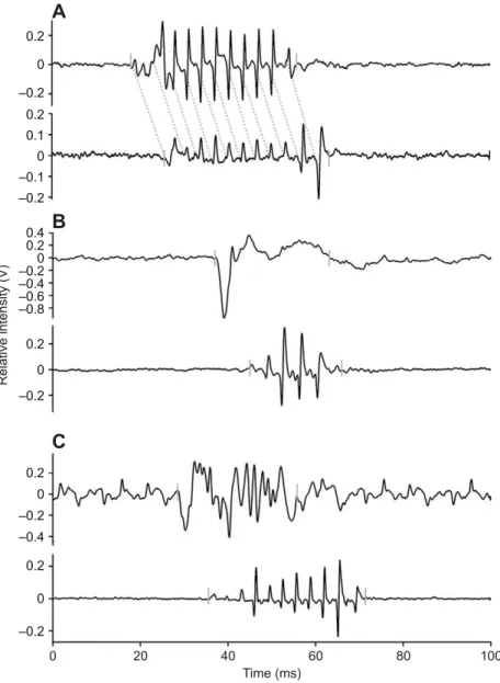Fig. 5. Ventral and dorsal sonic muscle electromyograms (EMGs) and associated sounds. (A) A VSM EMG (top) and the associated sound (bottom)