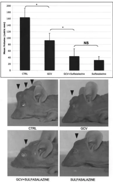 Figure 5. Effect of Sulfasalazine and GCV on the in vivo growth of chimaeric C6/C6-TK tumors