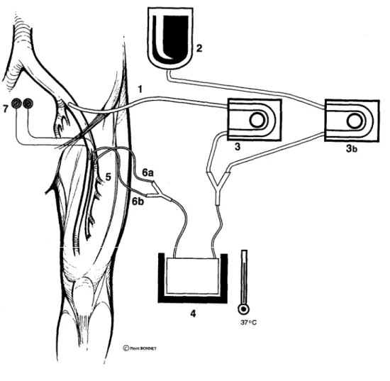 Fig. 1. Controlled limb reperfusion. 1, Inflow cannula; 2, asanguineous crystalloid solution; 3 and 3b, roller  pumps; 4, delivery line of controlled reperfusate; 5, heat exchanger; 6a and 6b, outflow cannulas inserted into  profunda and superficial femori