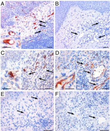 Fig. 1. Immunohistochemical analysis of human dermal granulation tissue and intact skin