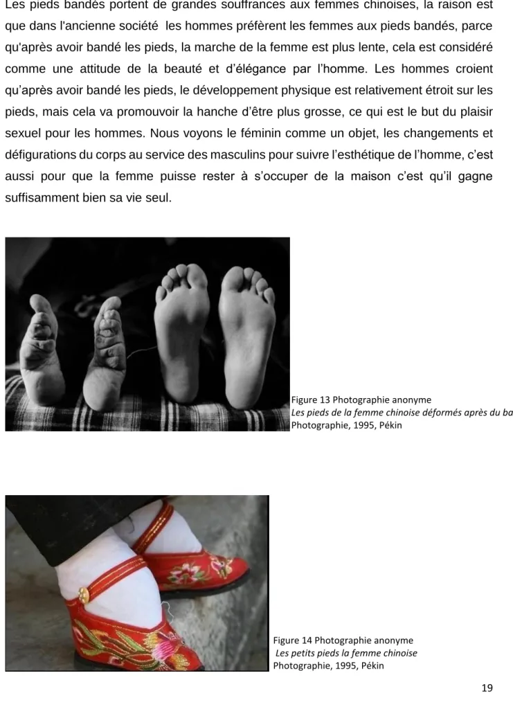 Figure 14 Photographie anonyme   Les petits pieds la femme chinoise  Photographie, 1995, Pékin 