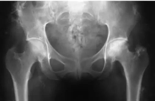 Fig. 1. Radiografía de pelvis.