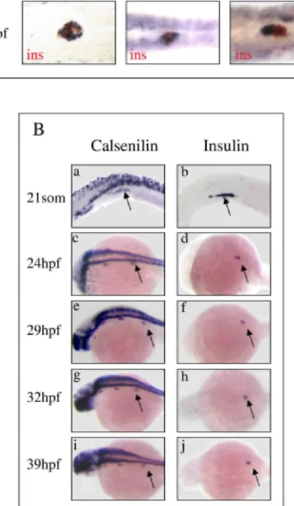 Fig. 1. Expression of calsenilin in the zebrafish pancreas.  A: Search for new genes expressed in the pancreas: zebrafish at 24  hours postfertil-ization (hpf) were cohybridized with digoxigenin-labeled antisense probes (in blue) corresponding to the gene 
