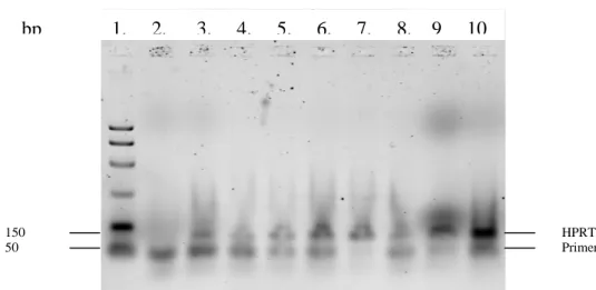 Figure 18: Analyse par RT-PCR de l’expression de l’ARNm de HPRT dans les lignées cellulaires étudiées (gel d’agarose 2%): 1.Smart Ladder, 2.H 2 O, 3.Neuro2A, 4.HEK, 5.HEK transfectées avec EFHC1 long, 6.PBMC, 7.SKNBE, 8.C6, 9.Jurkatt, 10.LN18