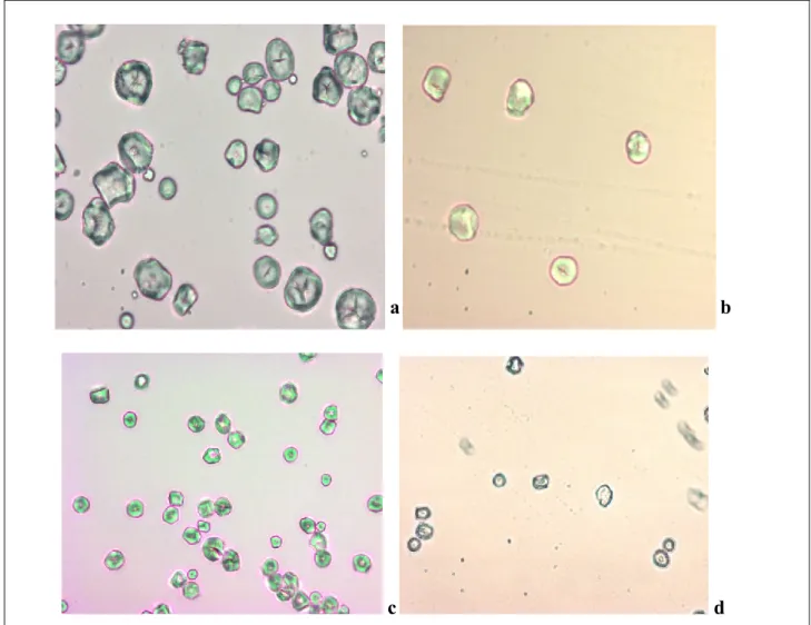 Figure 6.10 : Images des granules d’amidon observés au microscope optique (G 40x)  a : sorgho blanc, ASBI04 ; b : sorgho pigmenté, ASPI04,  