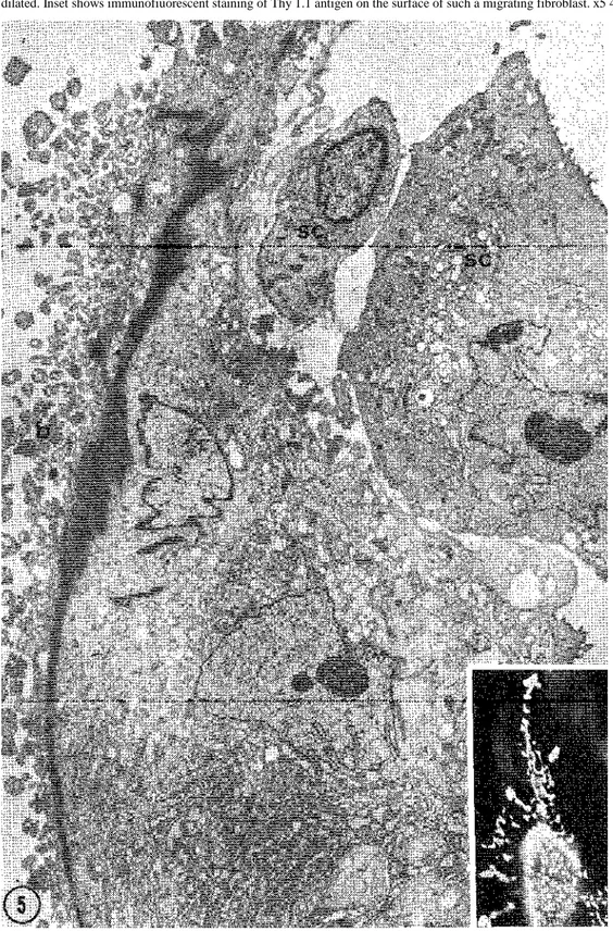 Fig. 5. TEM of a cell identified as a fibroblast migrating between SC. Numerous blebs (b) are present along the plasma membrane on the left
