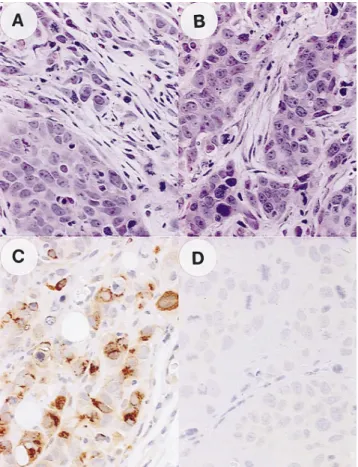 Figure 5. Histological and immunohistological analyses of tumors de- de-rived from MCF7hST3/9 and control MCF7pCMV/1 cell clones