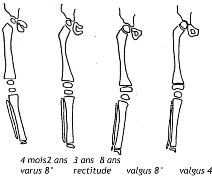 Figure 2 : Axes mécaniques des membres. Variations physiologiques en fonction de  l'âge