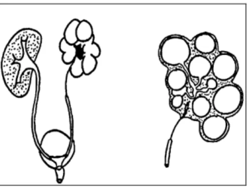 Figure 1 : Dysplasie multikystique. 