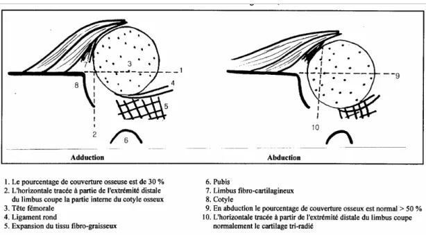 Figure 2 : ManÏuvre d'abduction et d'adduction de hanche en échographie. 