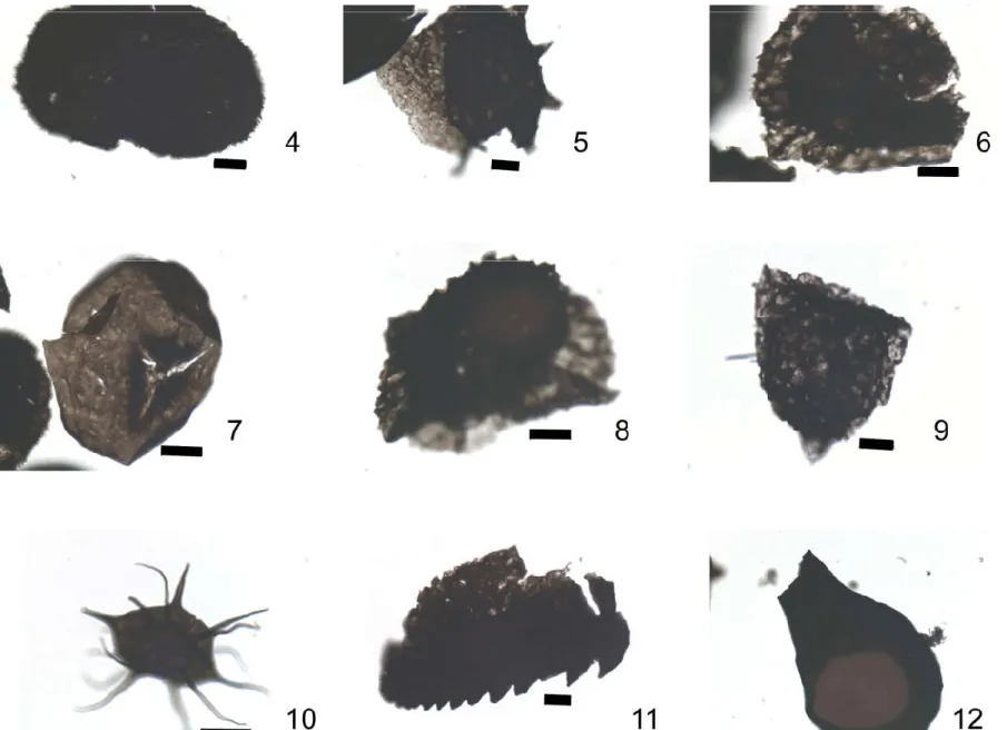 Figure 6. Observed palynomorphs in the Devonian of the Saint-Ghislain borehole. The black line beside each picture corresponds to a length of 10 µm