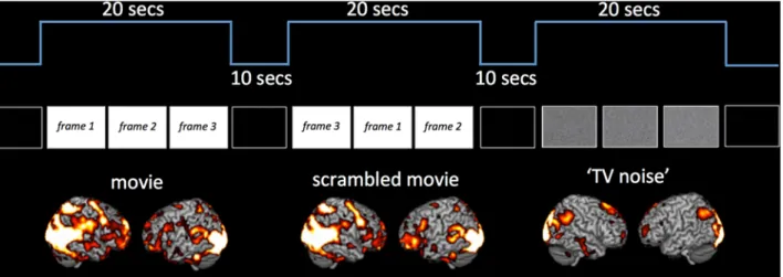 Fig 2. Block design results for movie, scrambled movie and ‘ TV noise ’ sequences. Figure displays overall brain activation for movie, scrambled movie and ‘ TV noise ’ sequences as measured in the block design paradigm