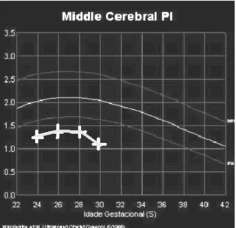 Figure 7 Abnormal pulsatility index (PI) curve of the middle cerebral artery.