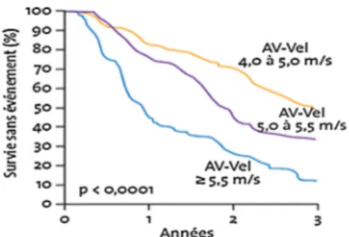 Fig. 1. En cas de sténose aortique sévère, la survie sans évènement est d’autant moins bonne que le pic de vitesse est élevé.