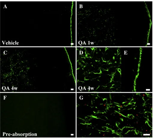 Fig. 4. Increase in SCF expression in the QA rat model. SCF expression detected by immunohistofluorescence in the striatum of vehicle-injected rat (A) or QA- QA-lesioned non-grafted rats 1 (B) and 4 (C – E) weeks post-injection
