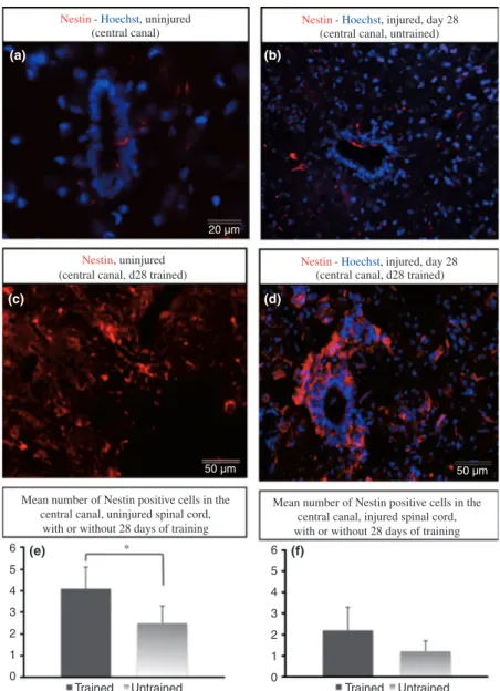 Fig. 4 Nestin expression by ependymal cells is maintained by exercise. Nestin immunofluorescent staining (red) of the central canal of uninjured spinal cord, without or with 28 days of treadmill training (a and c, respectively), and after spinal cord compr