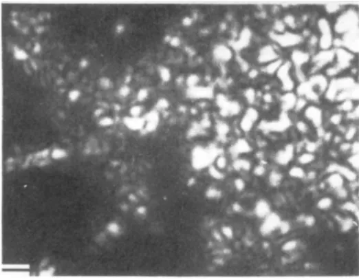 Figure 1.2 – Image d’un mucus d’escar- d’escar-got où les zones claires sont anisotropes.