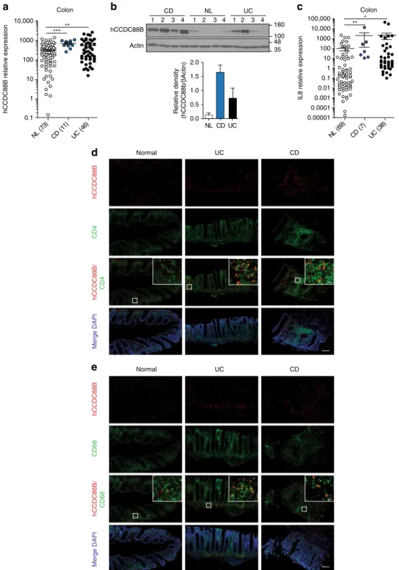 Fig. 6 CCDC88B expression in in ﬂ amed colons from patients with IBD. a CCDC88B mRNA expression in colon tissue samples extracted from surgical specimens of patients with Crohn ’ s Disease (CD, n = 11), Ulcerative colitis (UC, n = 46) or normal control (NL