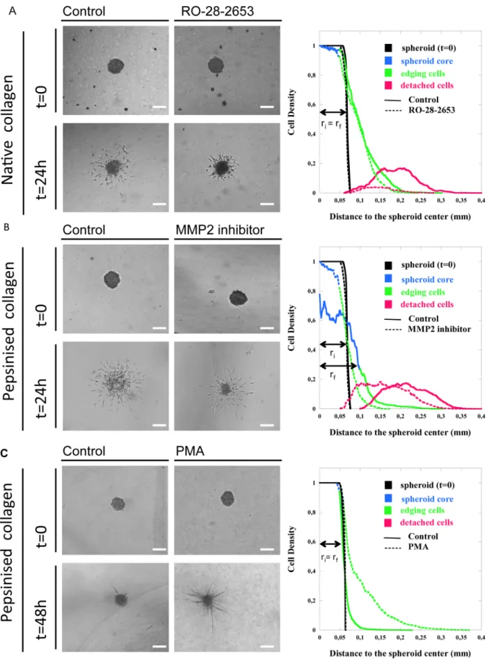 Figure 2. Spheroid assays in different collagen matrices. Two types of lymphatic endothelial cells, hTERT-HDLECs (a, b) and hMVEC-dly cells (c), were embedded in native collagen (2 mg/ml) (a) or in pepsinized collagen at a low (1,5 mg/ml) (b) or high conce