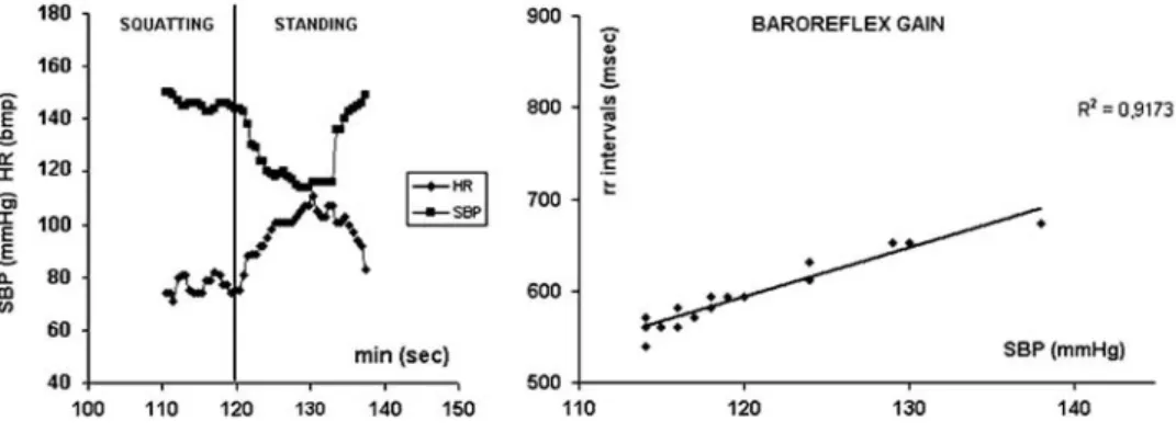 Fig. 2 Calculation of the baroreflex gain during a squat-stand test. Mirror image of changes in heart rate (HR)  and systolic blood pressure (BP) during the transition from squatting to standing and illustration of the mode of  calculation of the barorefle