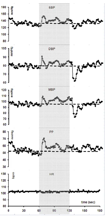Figure 2 : Changes in systolic (SBP), diastolic (DBP), and mean blood pressure (MBP), pulse  pressure (PP) and heart rate (HR) measured continuously with a Finapres® during a  standing-squatting (grey zone)-standing test in a patient with heart transplant