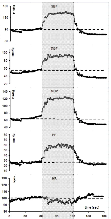 Figure 3 : Changes in systolic (SBP), diastolic (DBP), and mean blood pressure (MBP), pulse  pressure (PP) and heart rate (HR) measured continuously with a Finapres® during a  standing-squatting (grey zone)standing test in a patient with dysautonomia and s