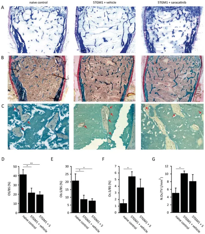 Figure 7: Histomorphometric analysis of bone parameters in the 5TGM.1 multiple myeloma model