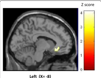 Figure 3 Activation of perigenual cortex in ONS responders vs.