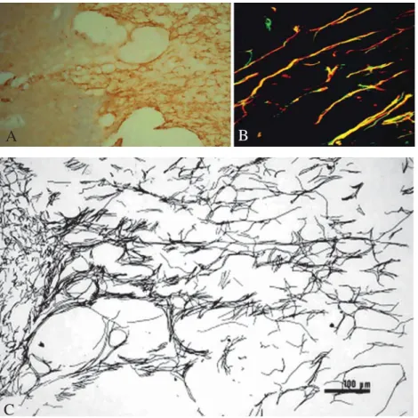 Fig. 5. Histology of axonal regeneration in the rat spinal cord, 14 days after compres- compres-sive injury