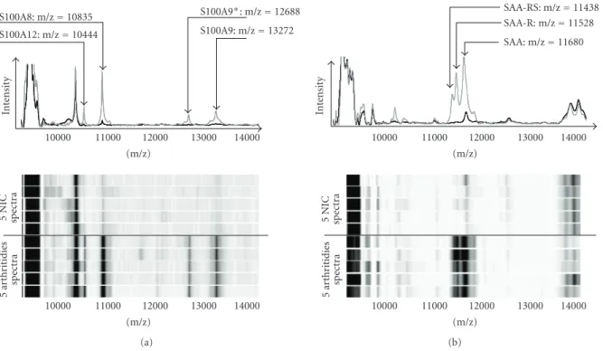 Figure 3: Protein mass spectra collected on CM10 and IMAC-Cu 2+ ProteinChip arrays with serum samples provided by five patients with arthritidies (including rheumatoid arthritis, psoriatic arthritis and ankylosing spondylitis) and five noninflammatory cont