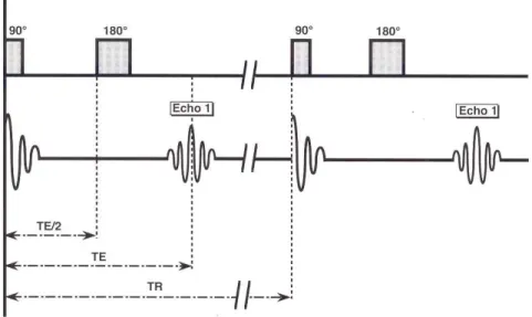 Figure  1.19  Chronologie des impulsions RF et paramètres de la séquence d’écho spin  (Kastler 1997)