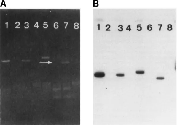 Fig. 3.  Hybridisation of different Vir plasmids of E. coli with the probe derived from pEOSW1