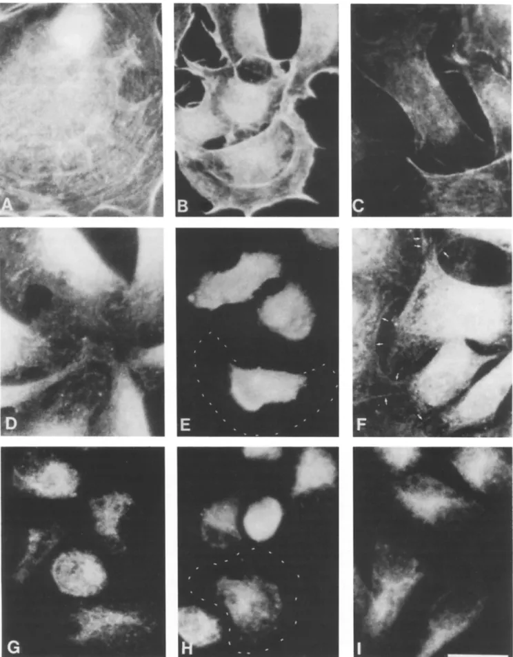 Figure 4.  Immunofluorescence localization of matrix-binding proteins in BAECs  1 h  after plating