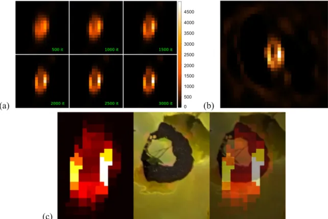 Figure 5. In panel ( a ) , the local Loki reconstructions corresponding to increasing numbers of iterations of the MRL method with boundary effect correction and in panel ( b ) the BB reconstruction are shown