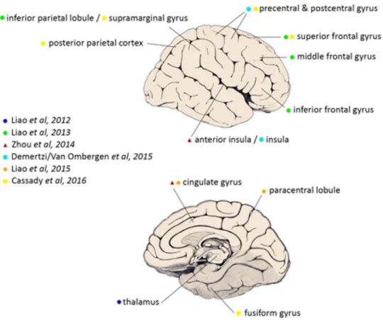 Fig. 3 The ﬁ gure shows decreased connectivity strength in the right insula, a critical region of the vestibular cortex, when comparing post- ﬂ ight to pre- ﬂ ight in a cosmonaut