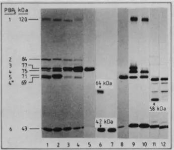 FIG. 1. SDS-PAGE and fluorography of benzyl[&#34;4C]penicillin- benzyl[&#34;4C]penicillin-labeled membranes of E