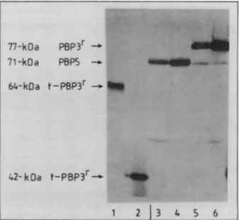 FIG. 4. SDS-PAGE and Coomassie blue staining of t-PBP 3Y and t-PBP 3S peptide fragments