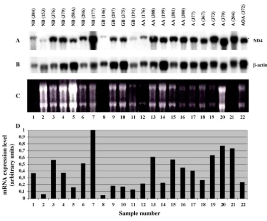 Fig. 4. Expression of ND4 gene in normal human tissues and in brain tumors. (A) Northern blot hybridization of 32 P-labeled ND4 cDNA probe with tumor RNA panel