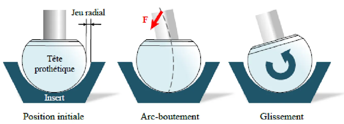 Figure 16 : Cinématique du squeaking suivant une instabilité de type « Sprag-Slip » 